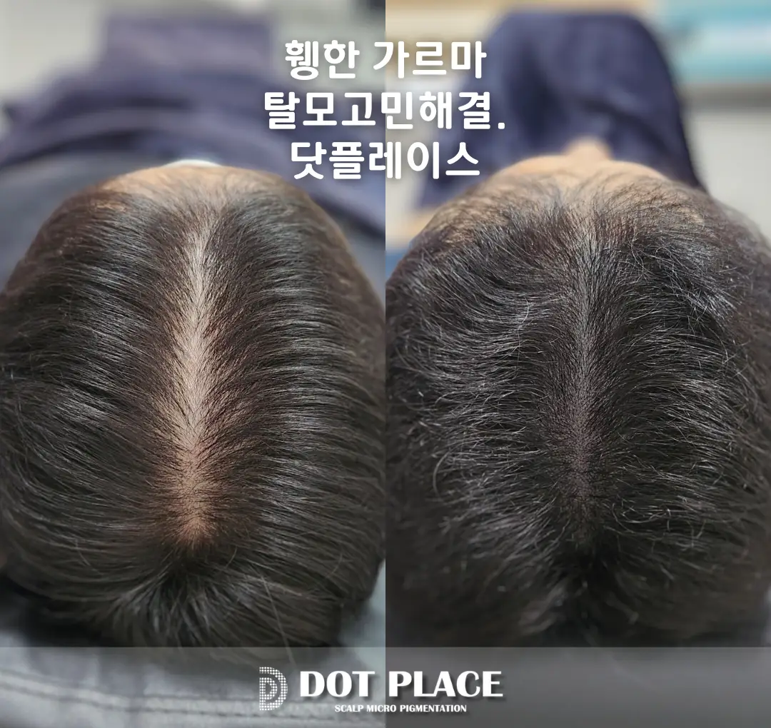 이미지 7