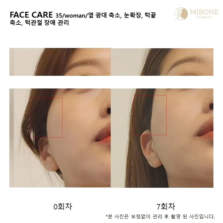 이미지 9