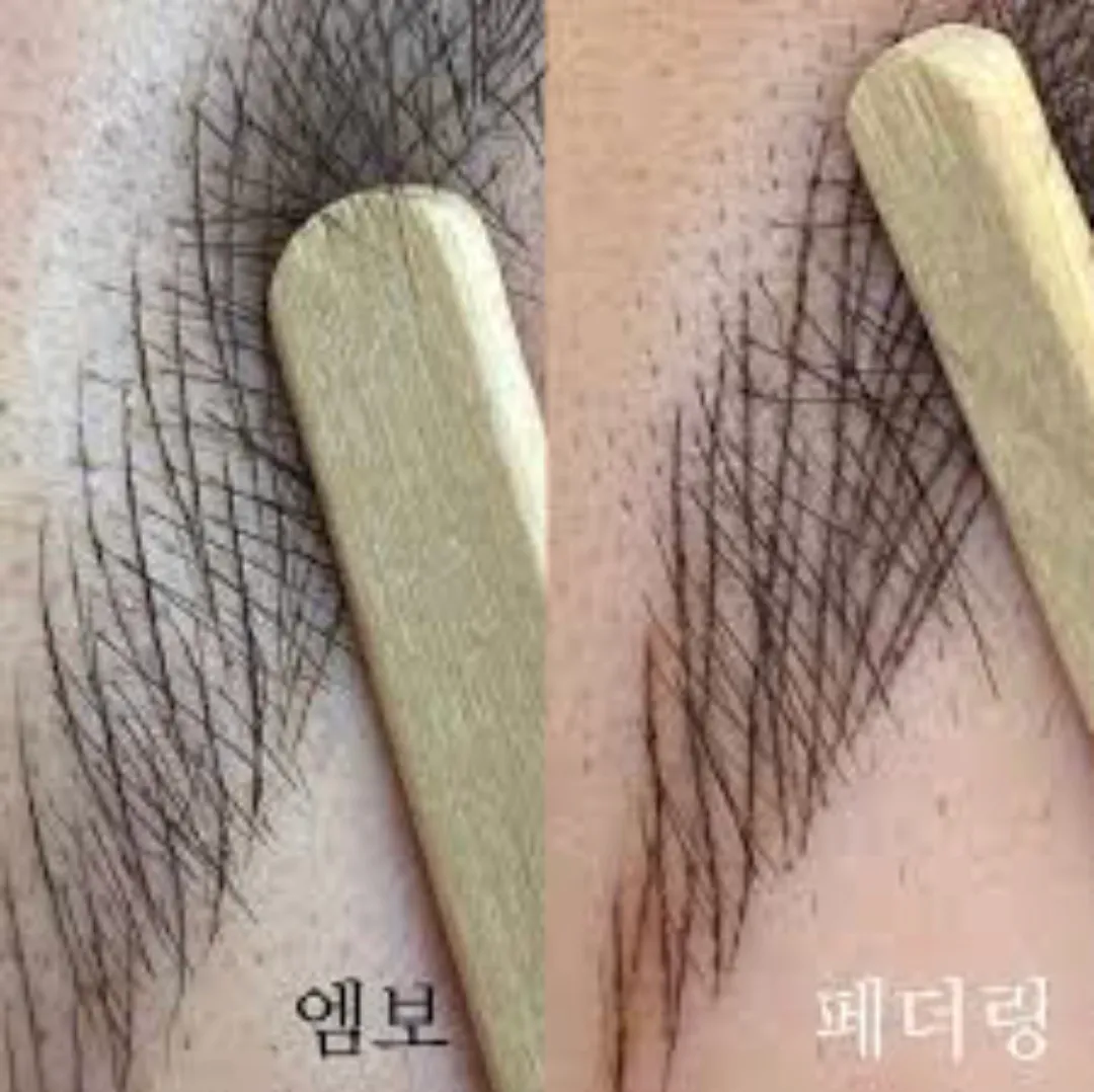 이미지 3