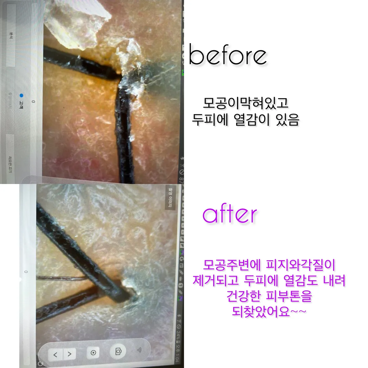 이미지 8