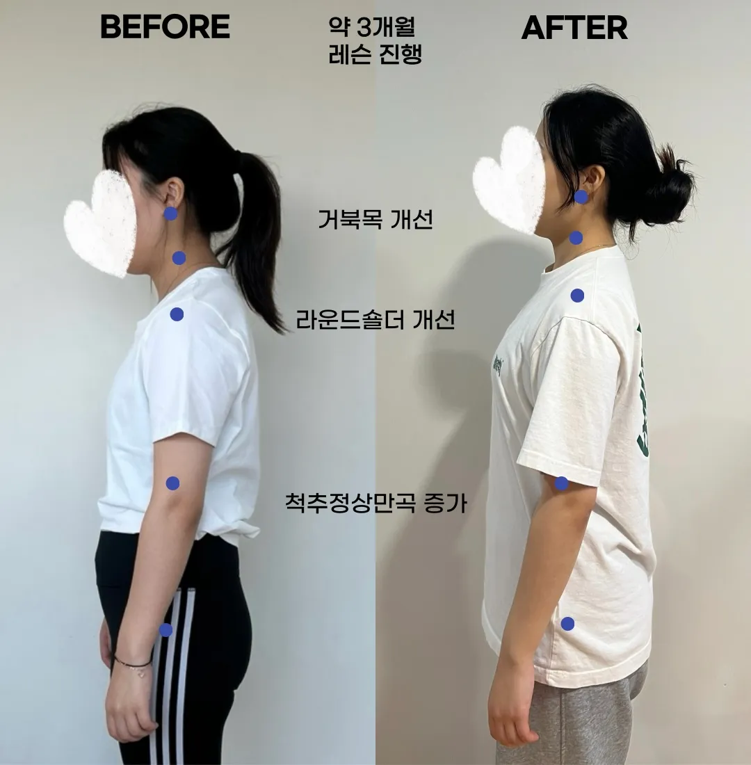 이미지 6
