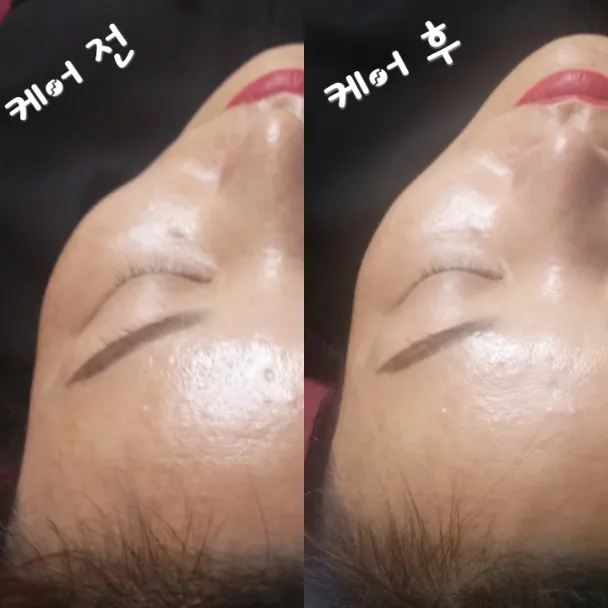 이미지 3