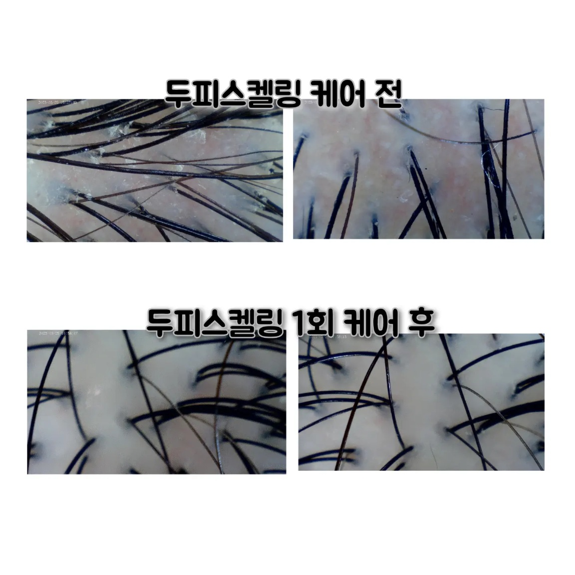 이미지 5