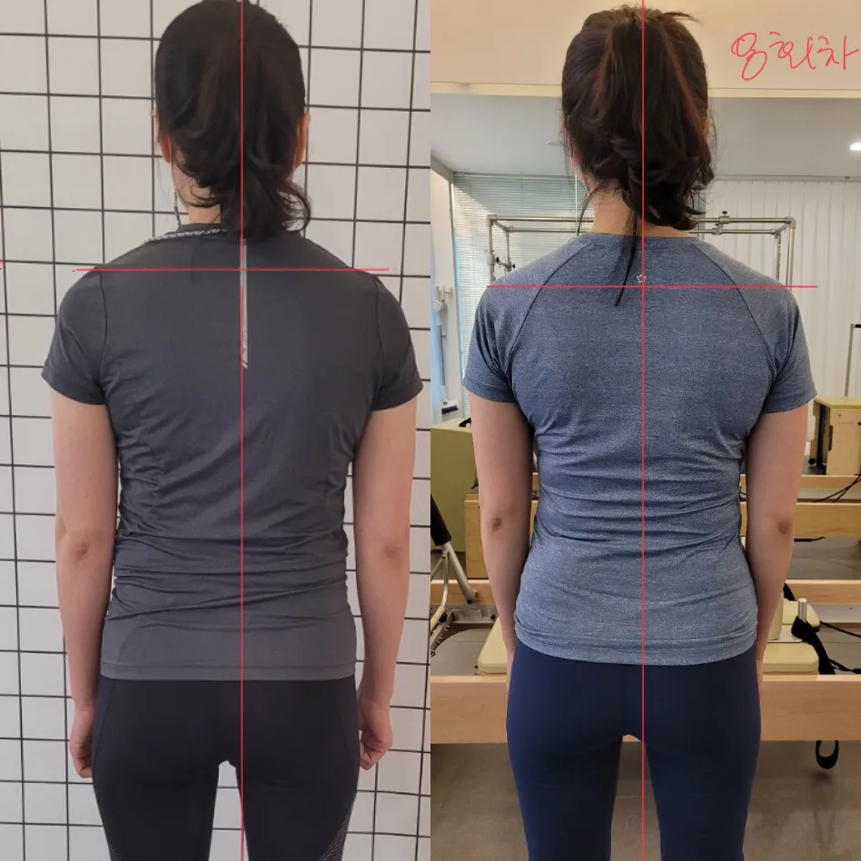 이미지 7