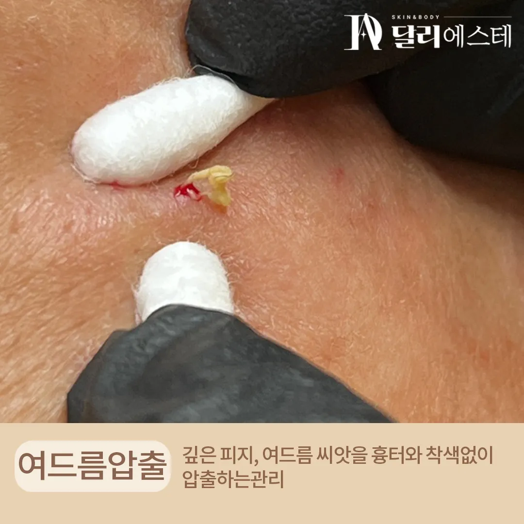 이미지 5