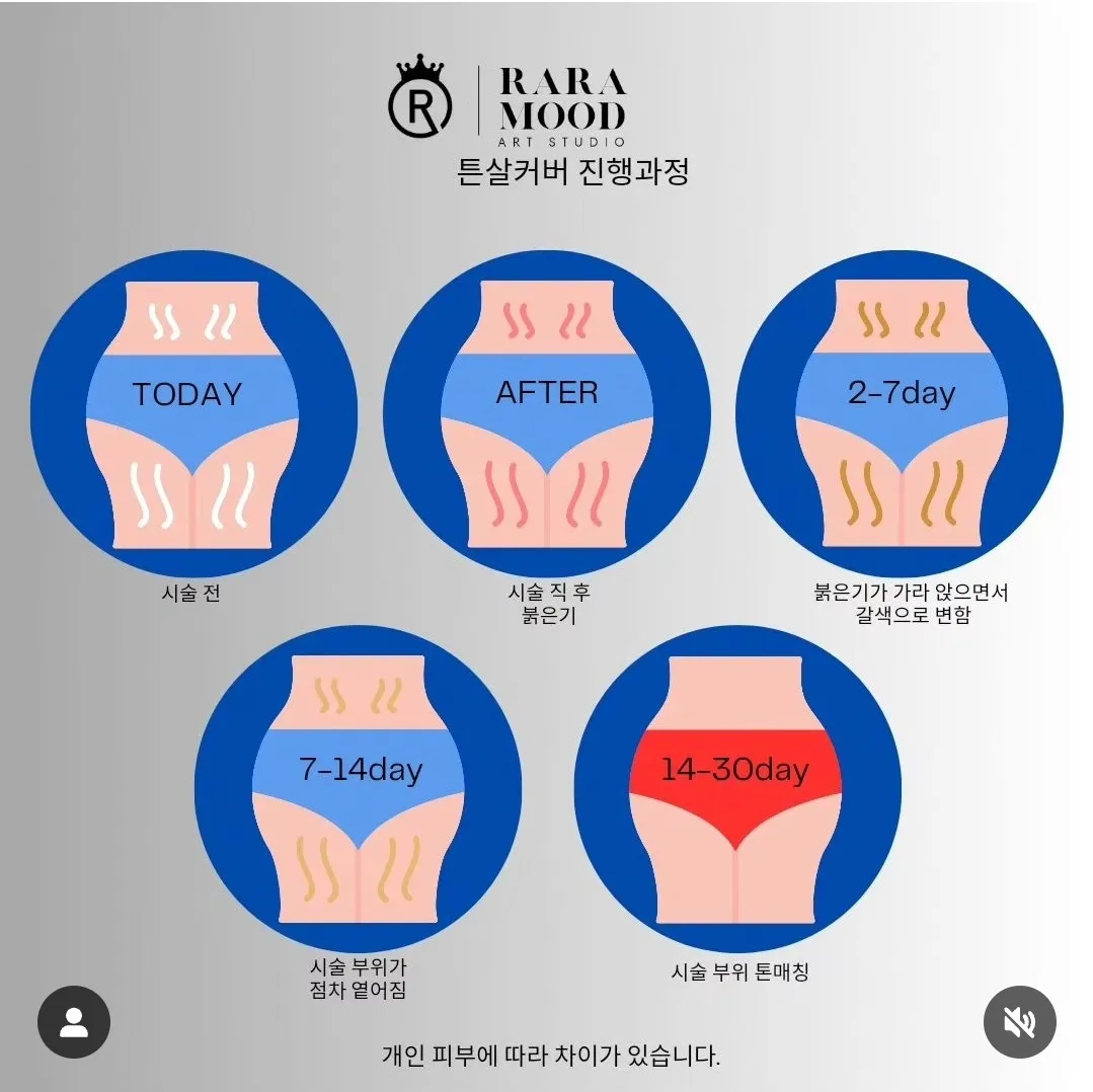 이미지 8