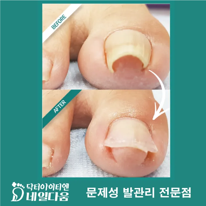 이미지 5