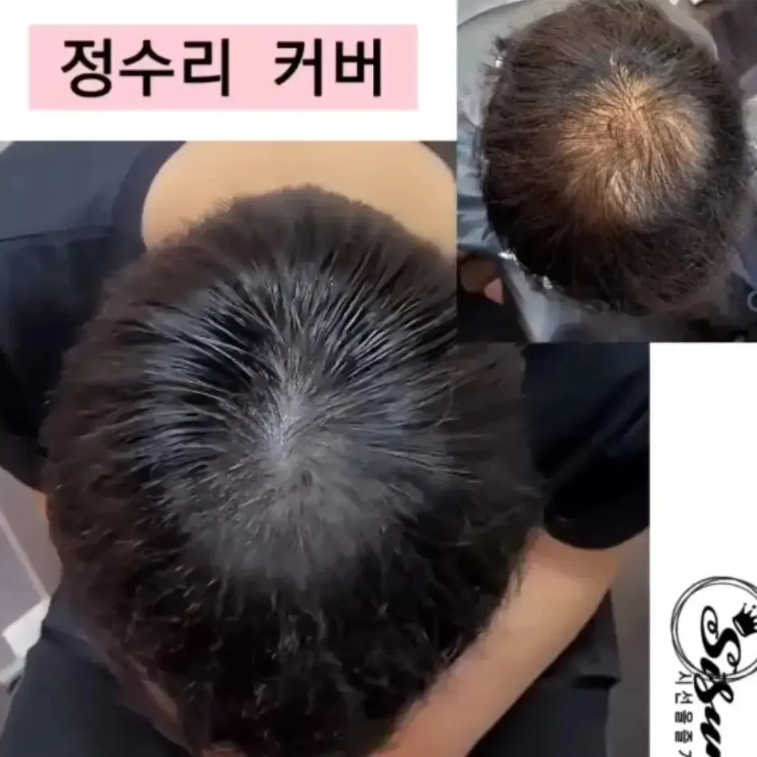 이미지 3