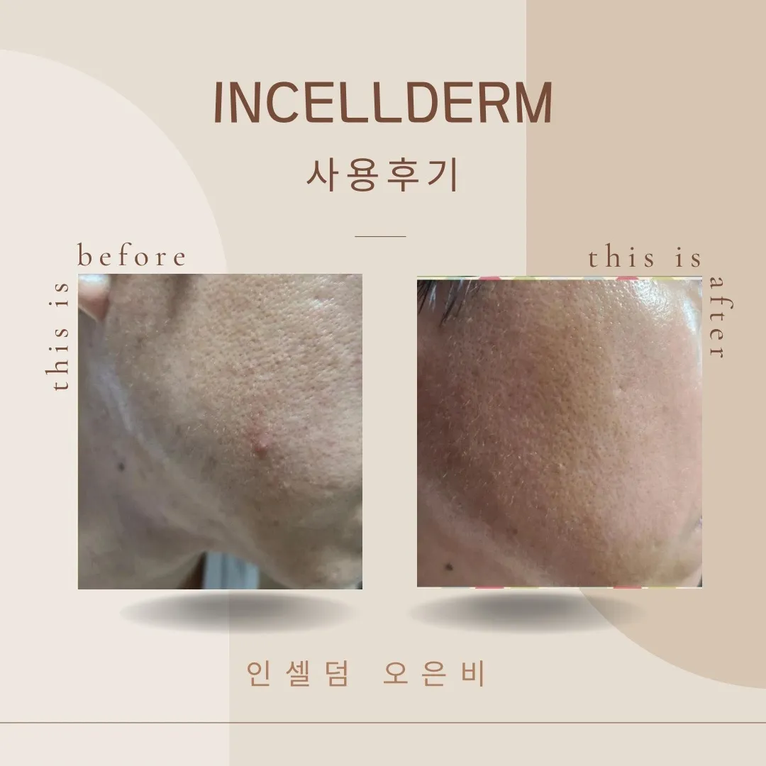 이미지 6