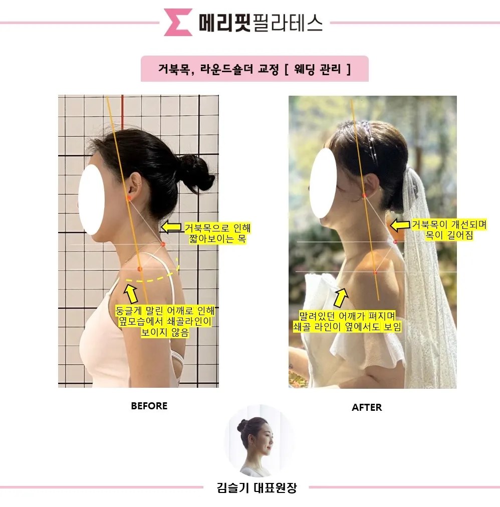이미지 5