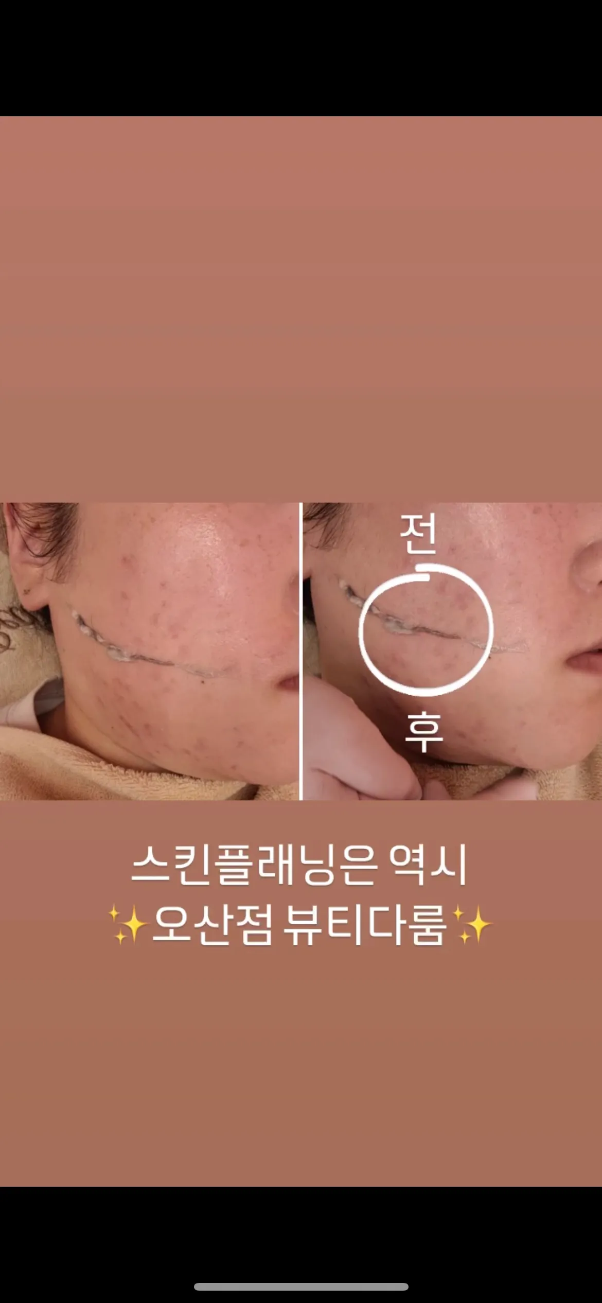 이미지 6