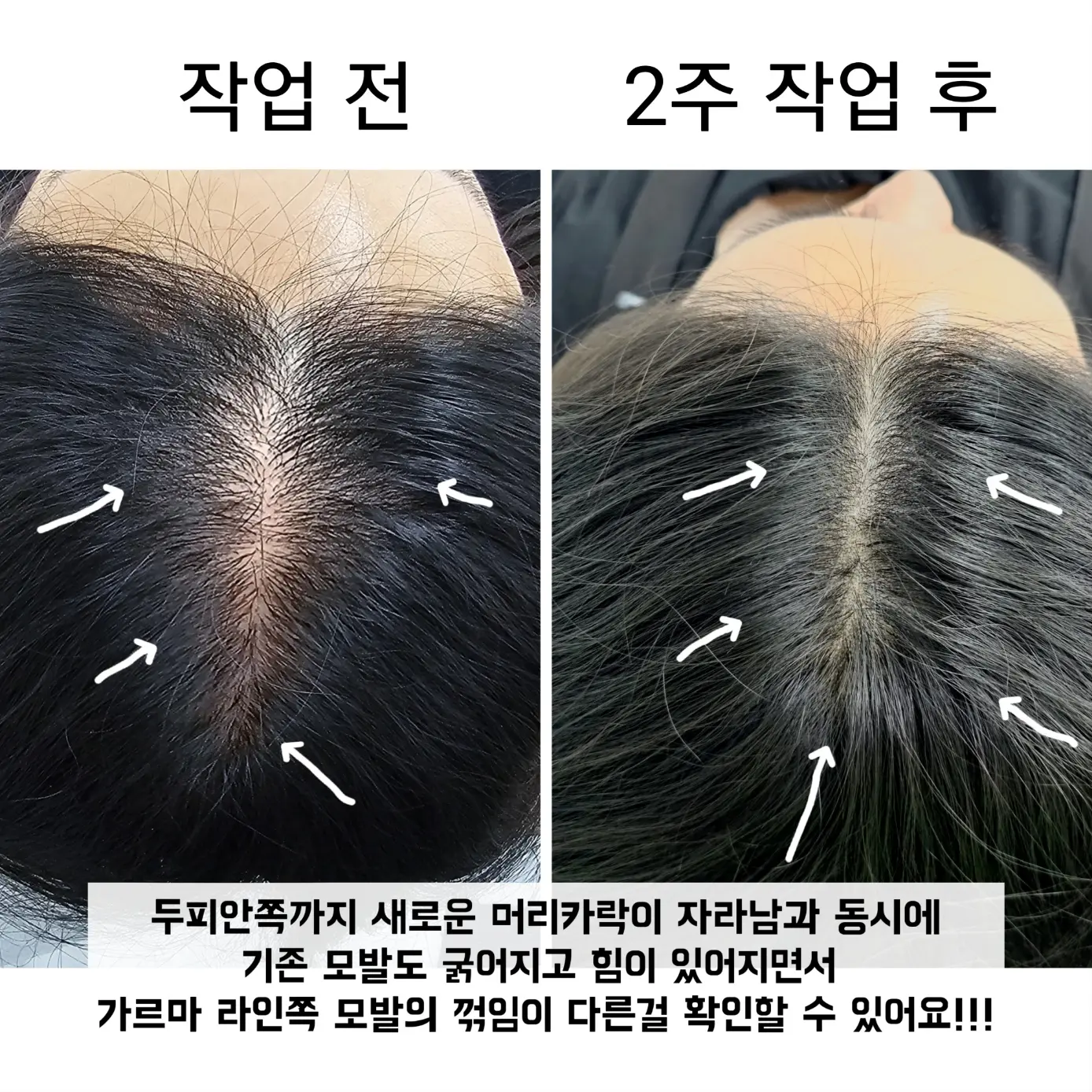 이미지 6