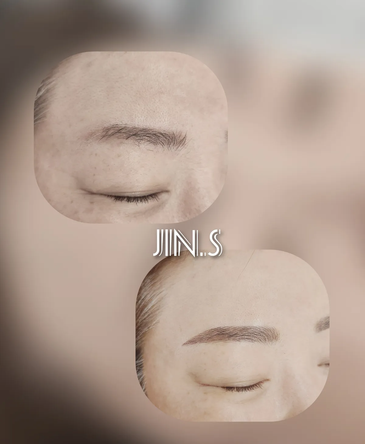 이미지 11