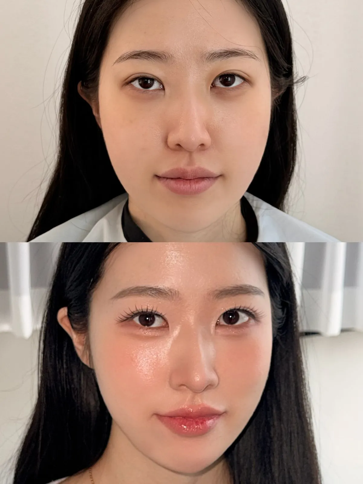 이미지 2