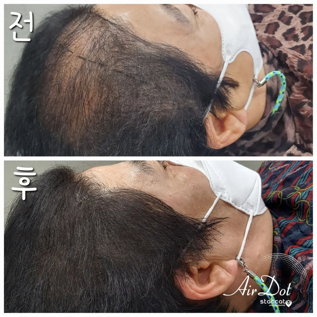이미지 6