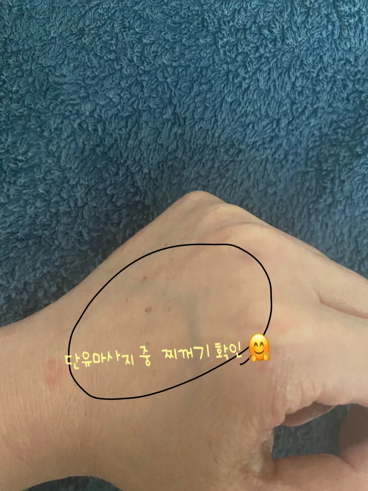 이미지 11