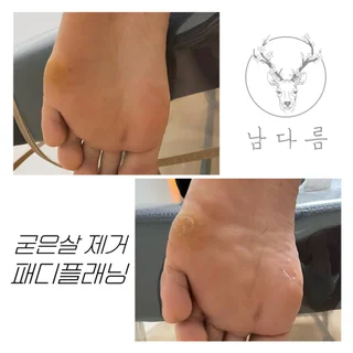 패디플래닝