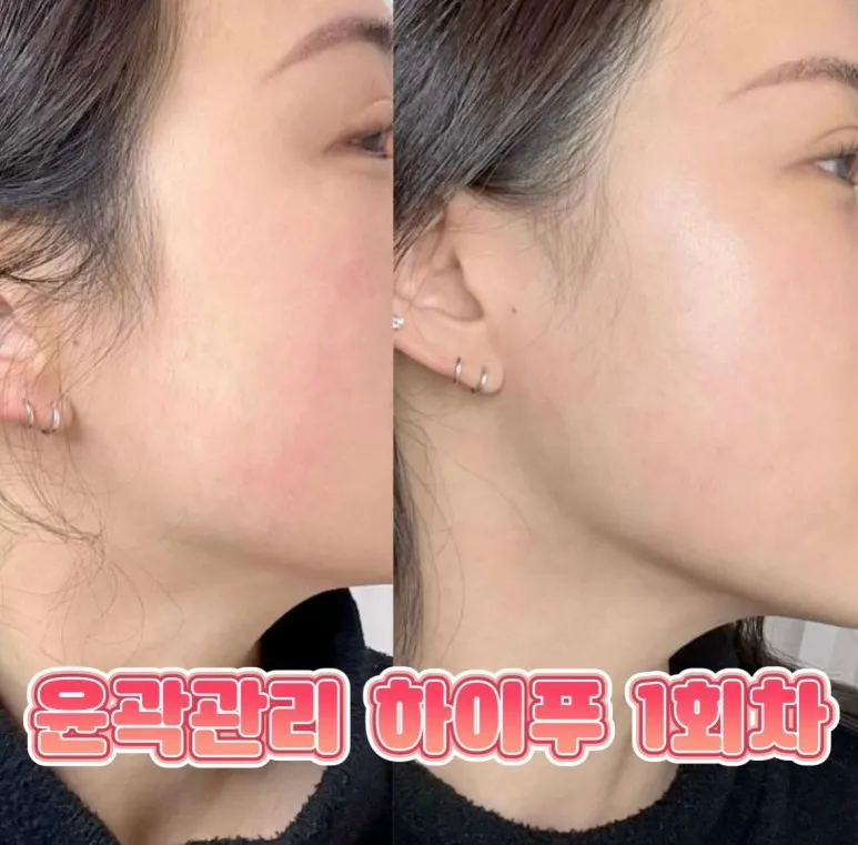 이미지 5