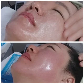 양자 진단 슈퍼젝션으로 주름·탄력·톤 동시 개선! 라라라뷰티의 맞춤 피부 솔루션