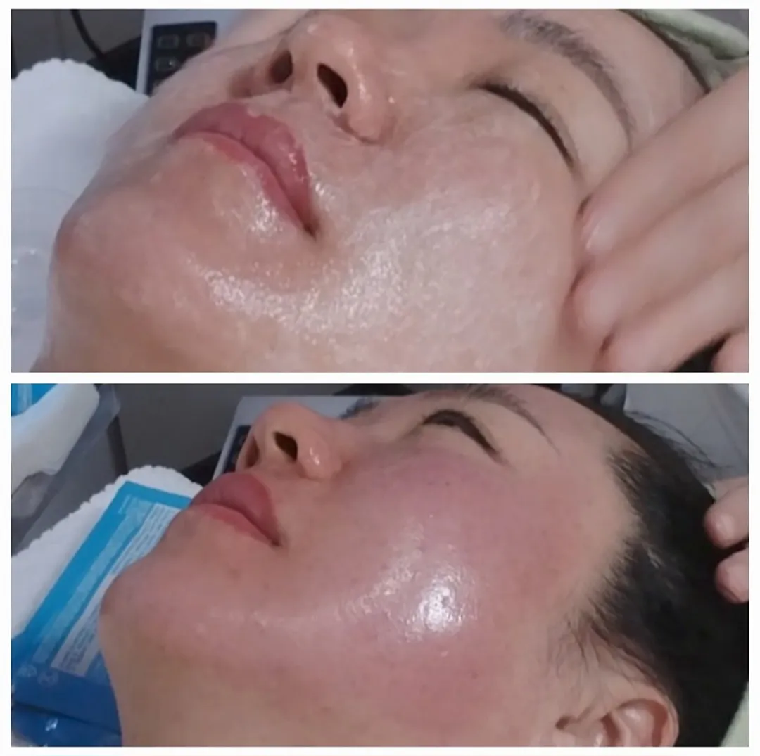 이미지 5