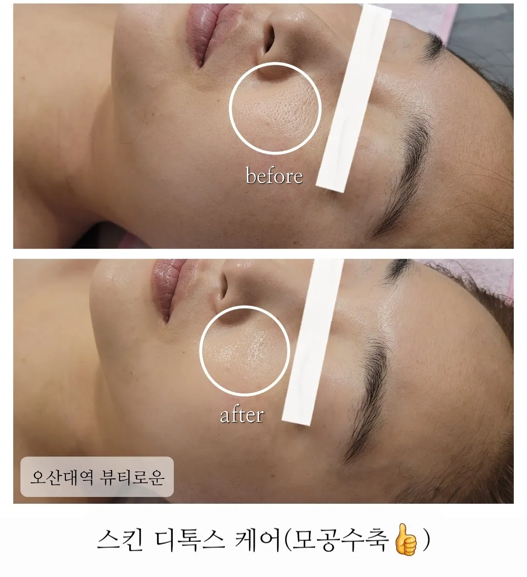 이미지 3