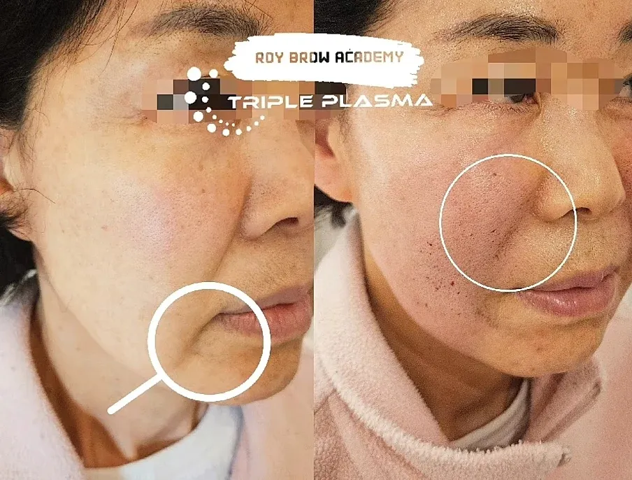 이미지 7