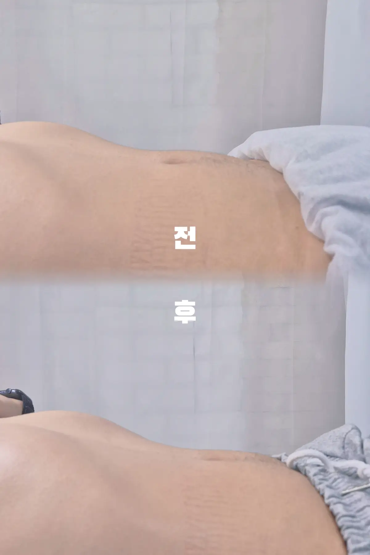 이미지 7