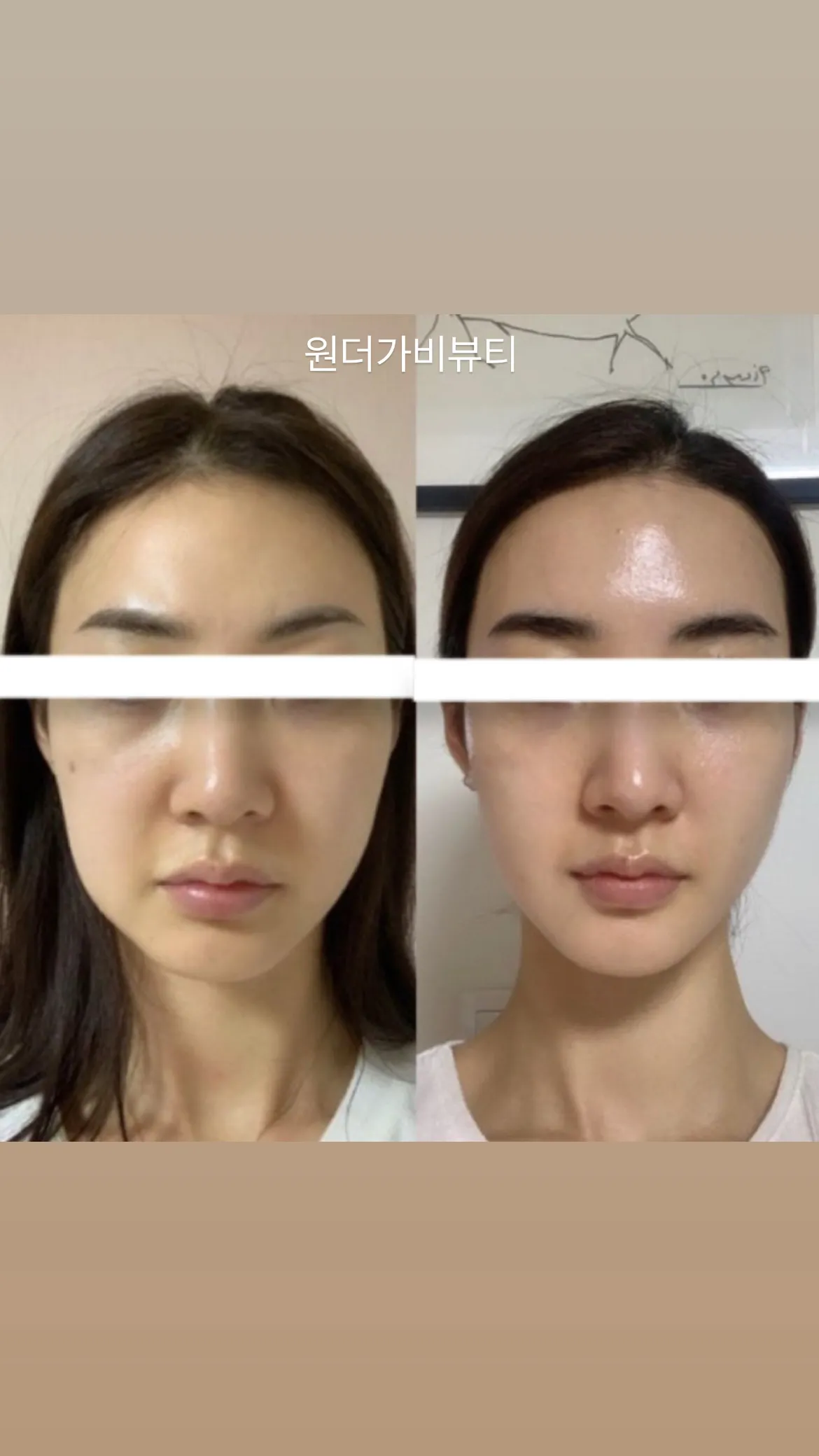 이미지 3