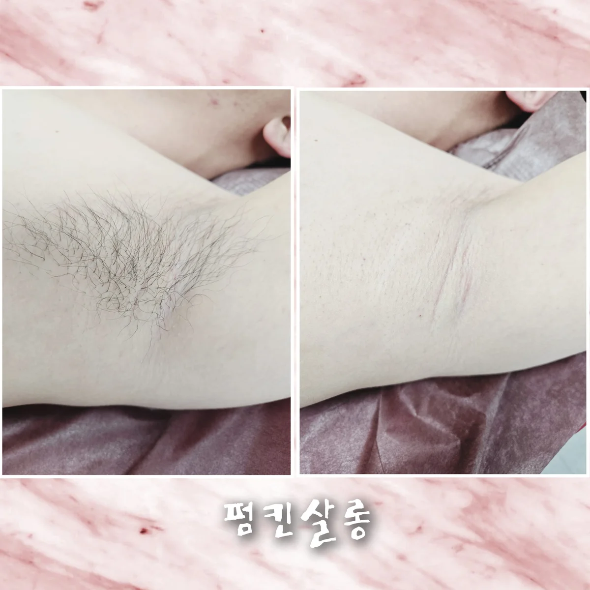 이미지 5