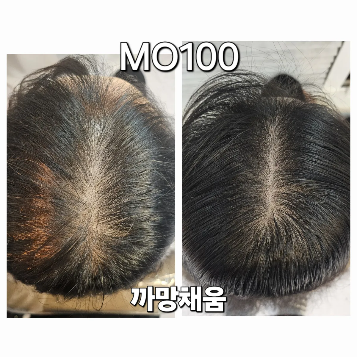 이미지 11