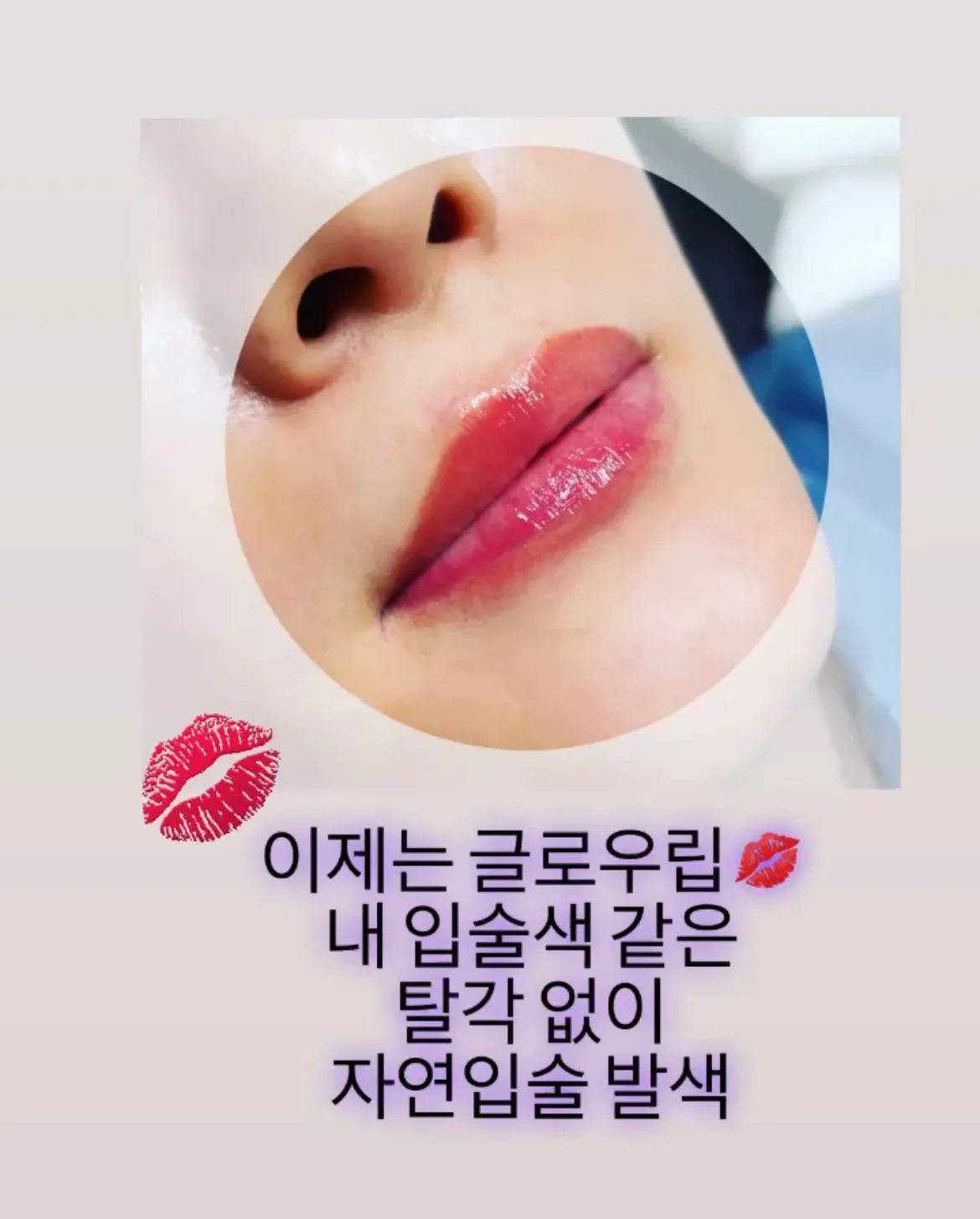 이미지 6