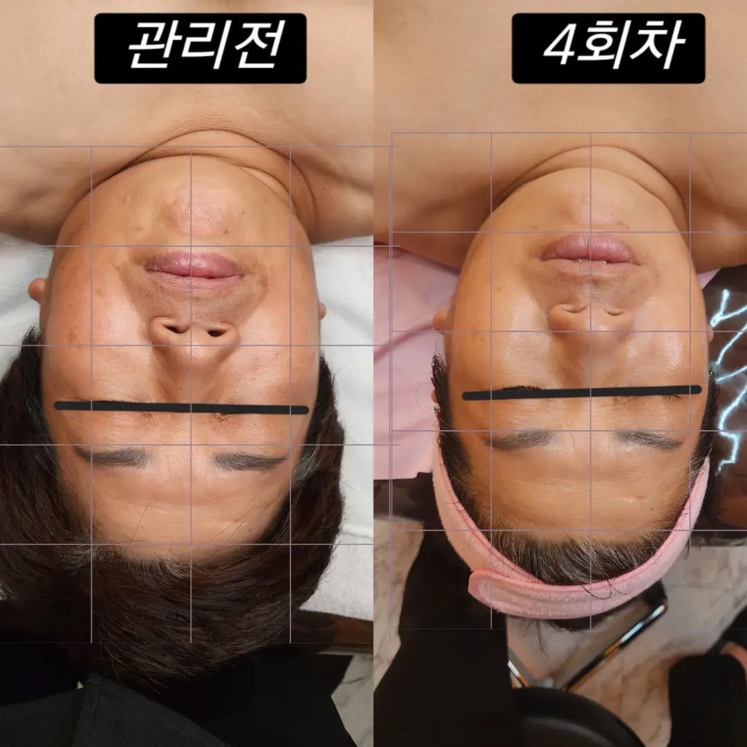 이미지 5