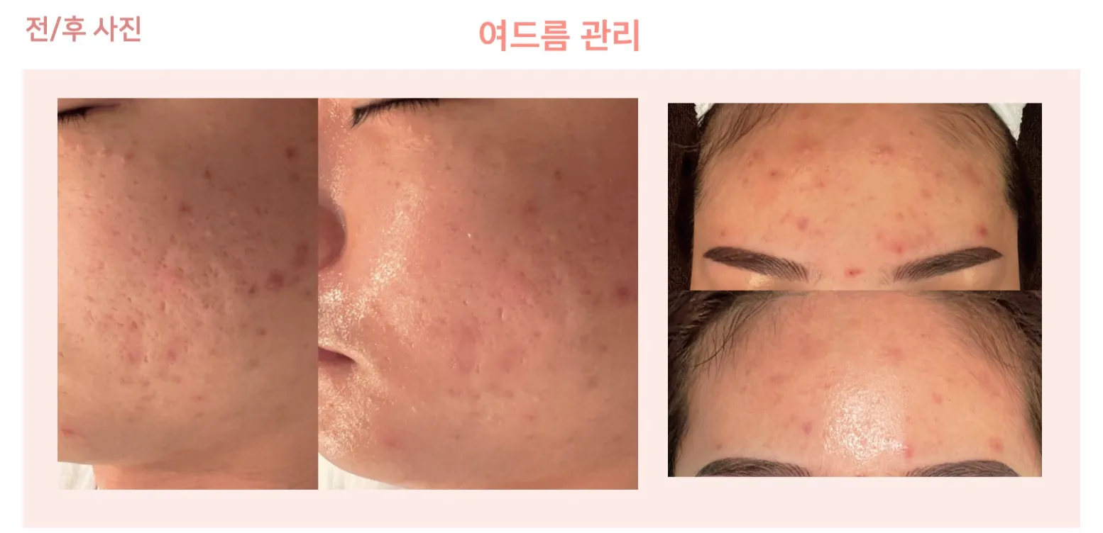 이미지 3