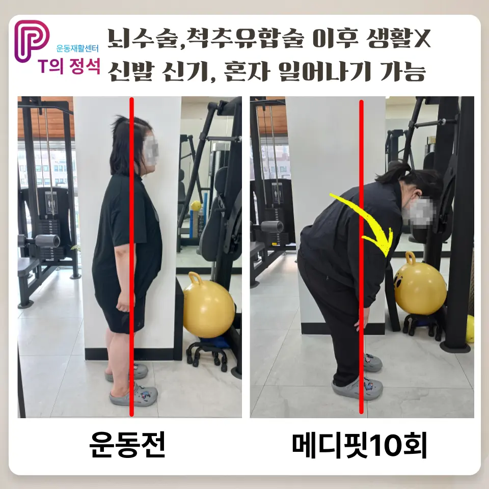 이미지 10