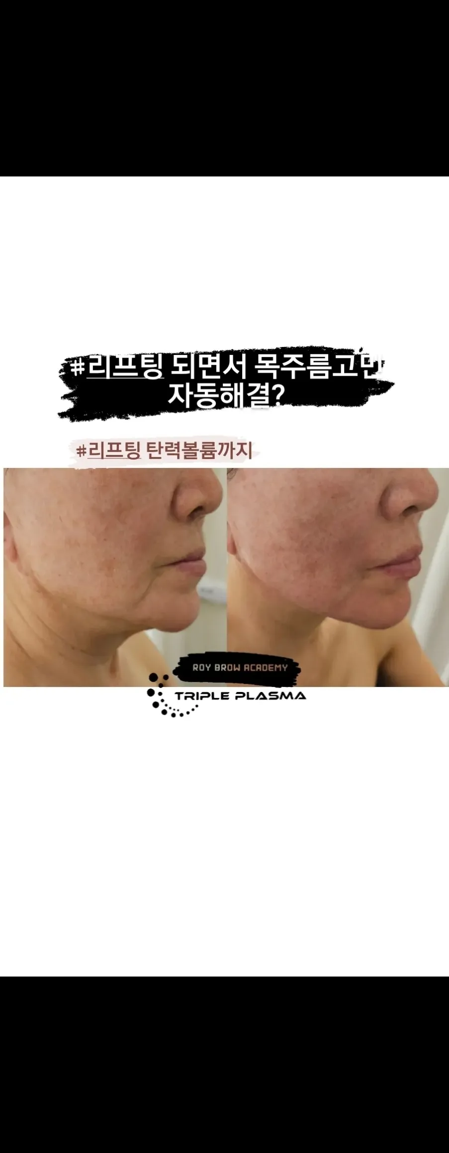 이미지 10