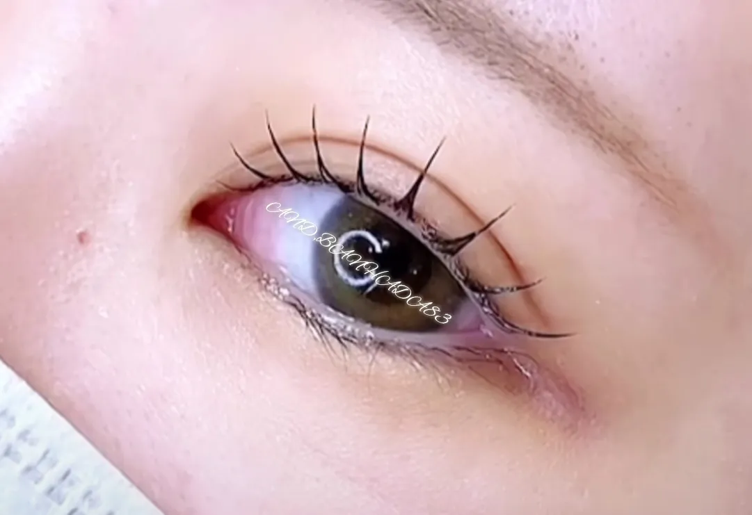 이미지 3