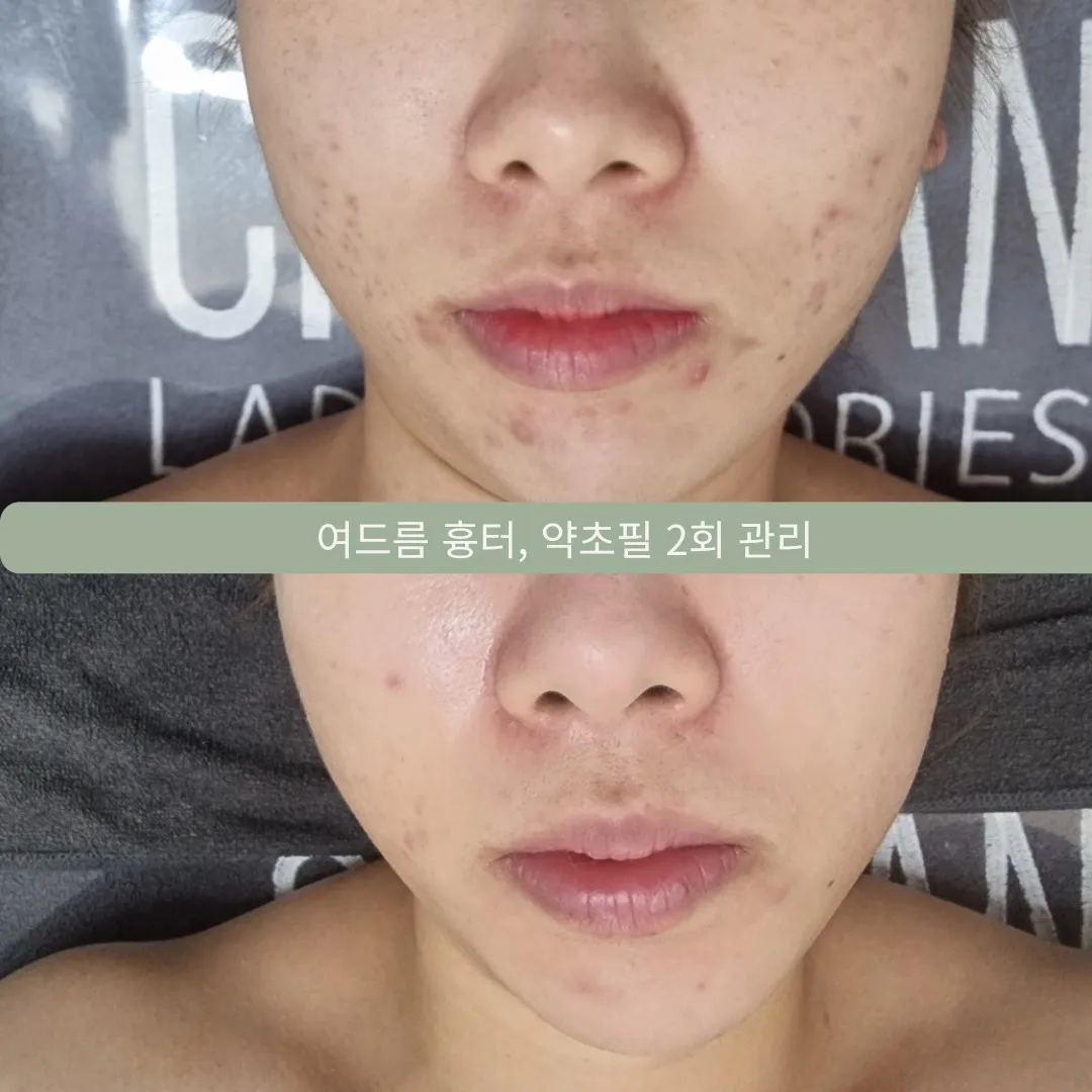 이미지 22