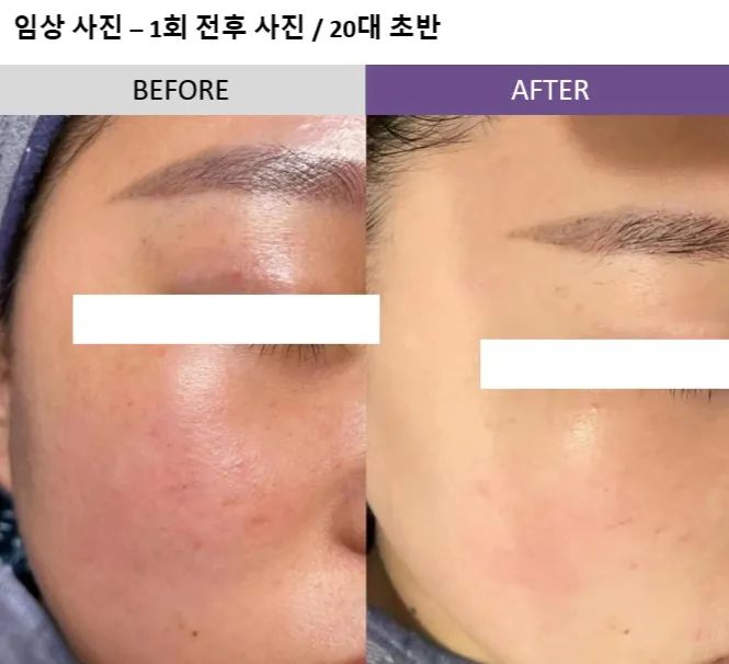 이미지 8