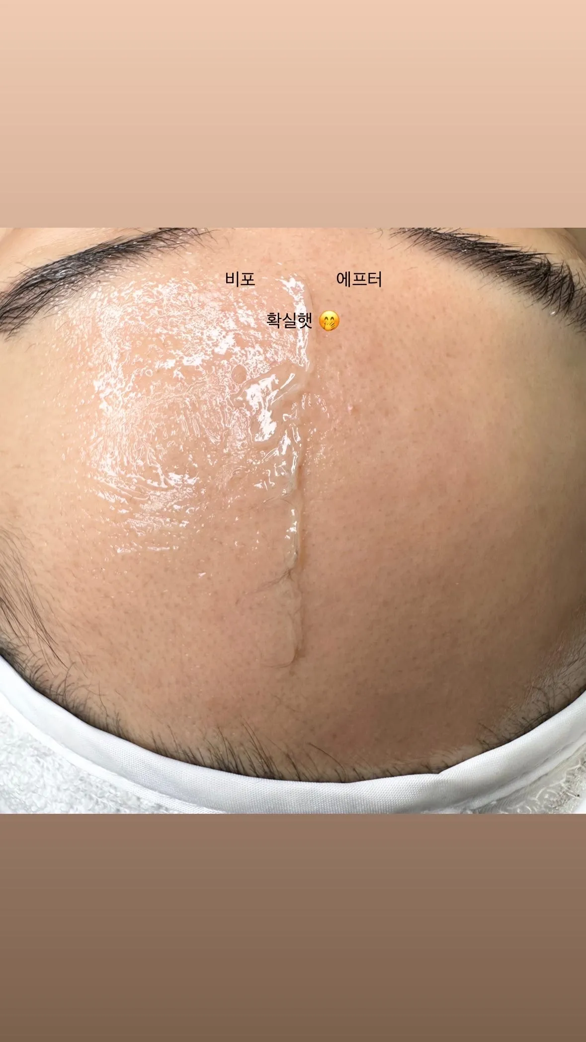 이미지 10