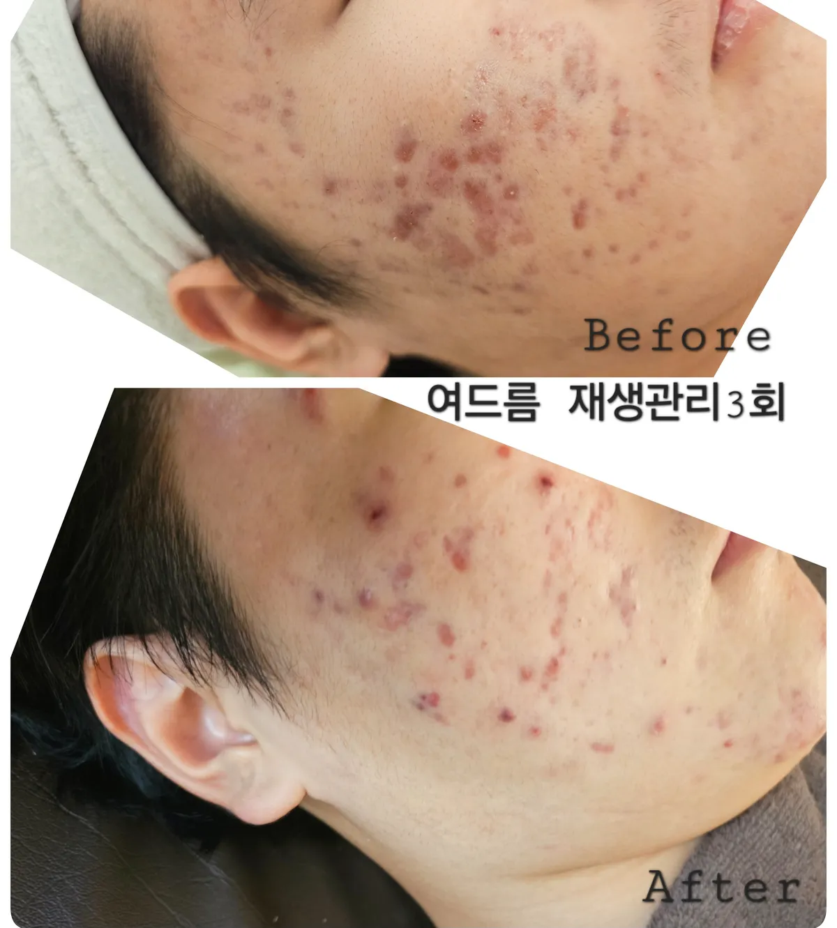 이미지 10