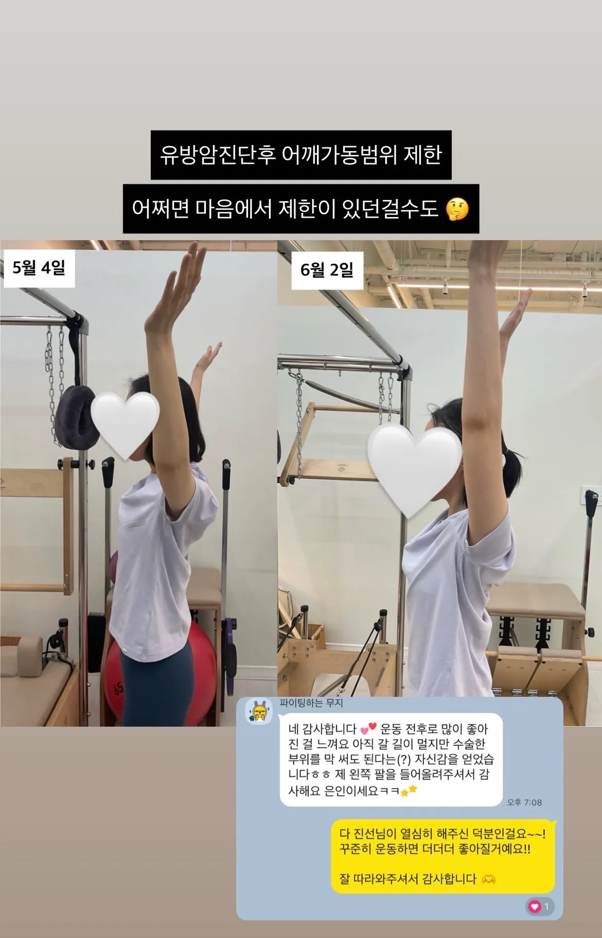 이미지 2