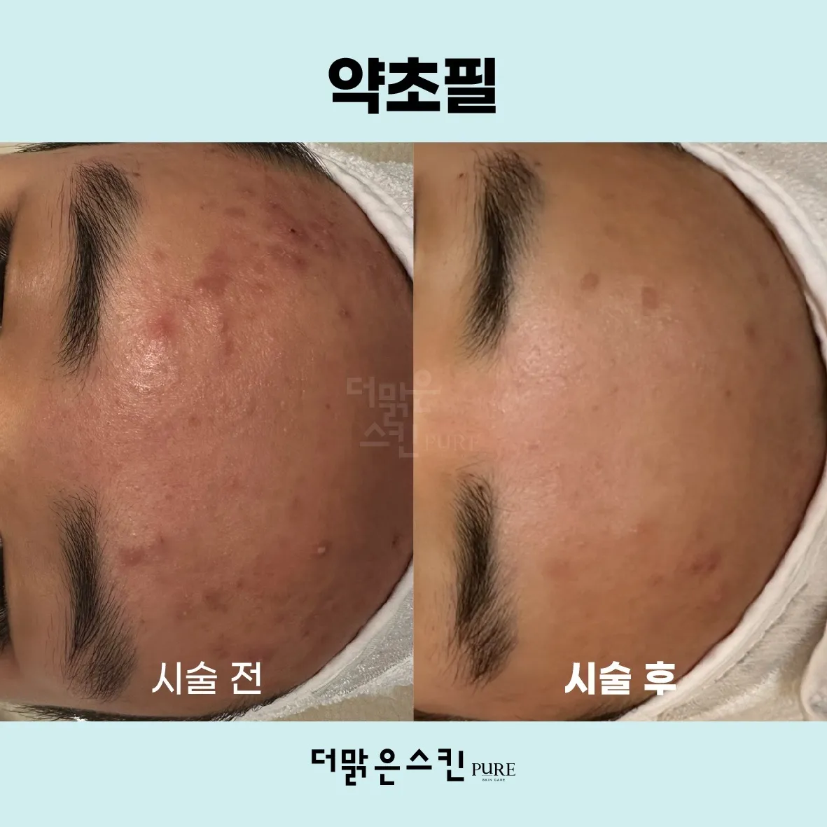 이미지 3