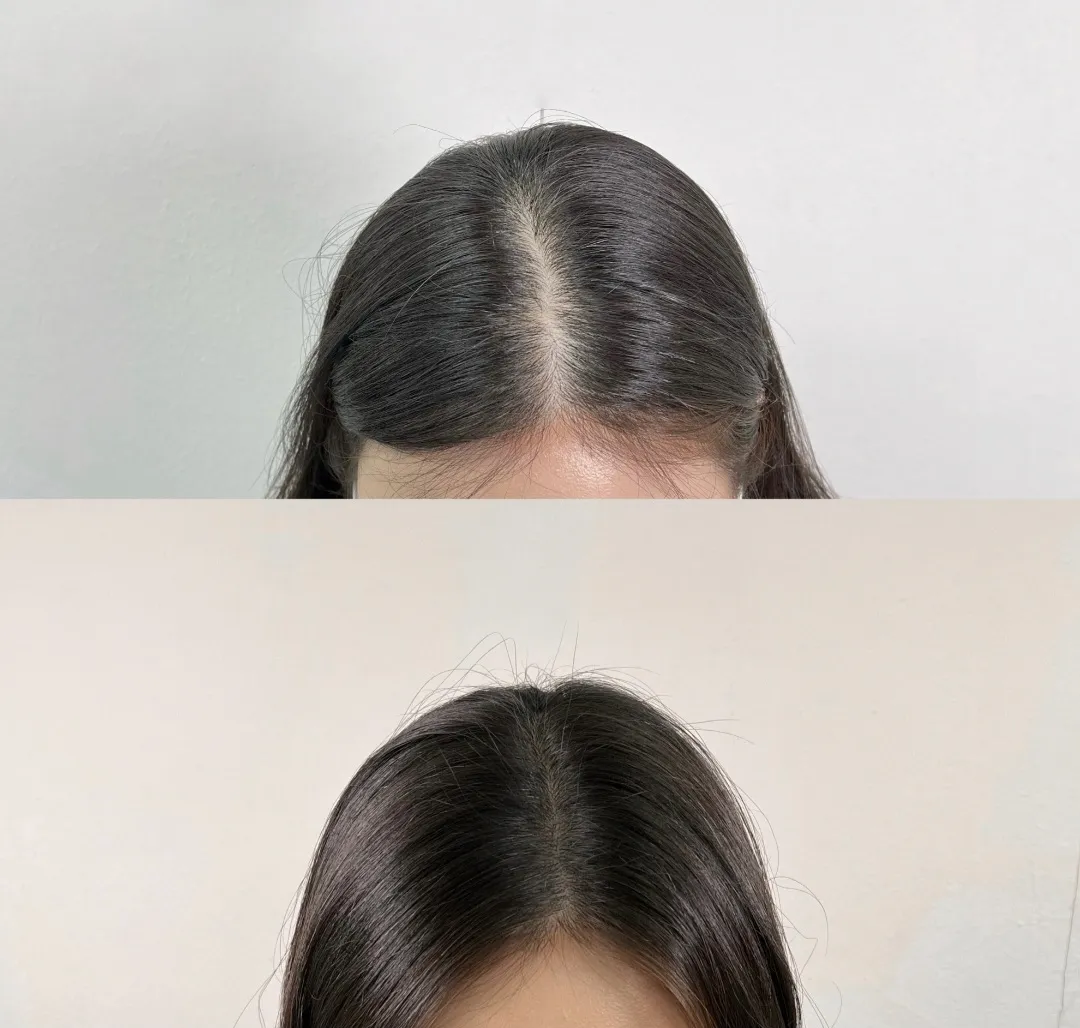 이미지 3