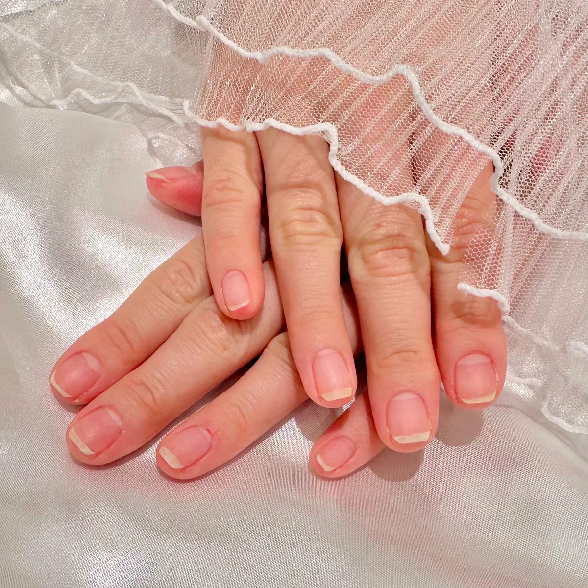 이미지 6