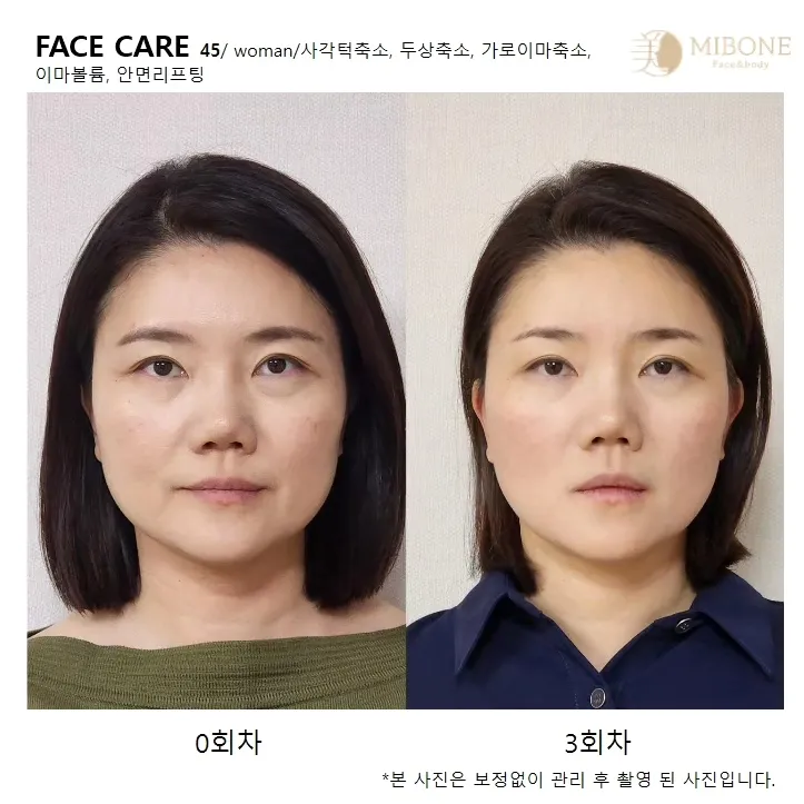 이미지 6