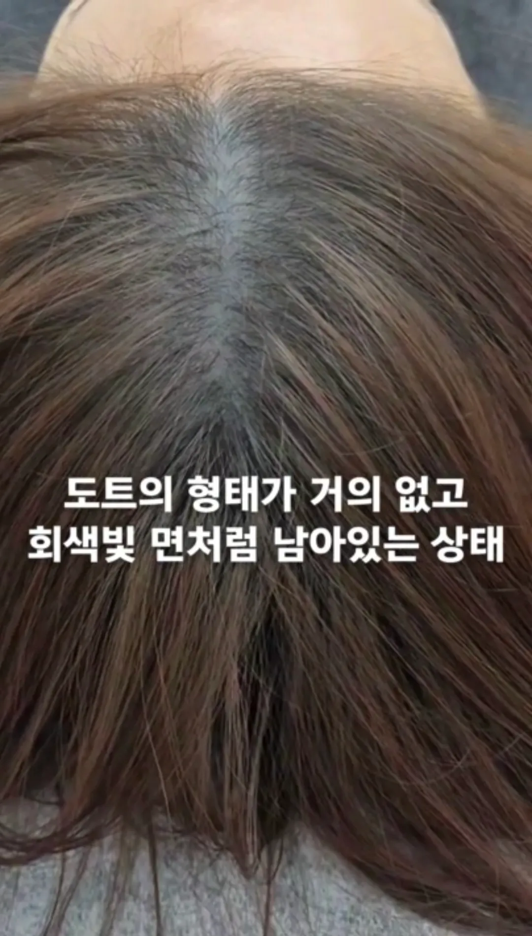 이미지 7
