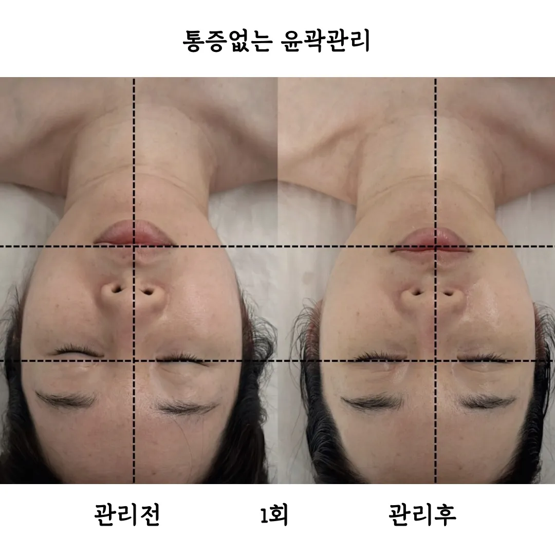 이미지 5