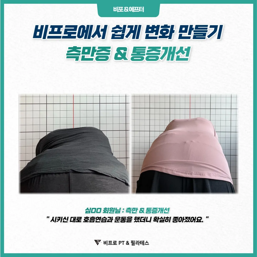 이미지 11