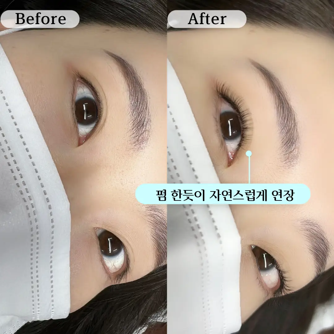 이미지 6