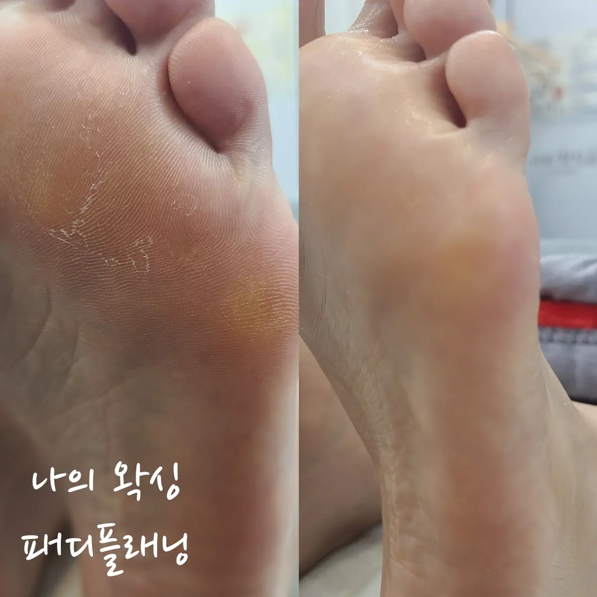 이미지 5